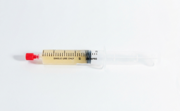 A syringe filled with a yellowish liquid and a red sterile syringe cap, labelled SINGLE USE ONLY, on a white background.